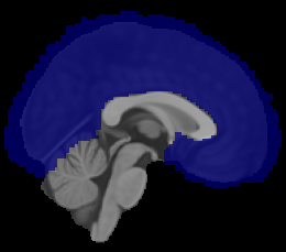 Cerebral Cortex