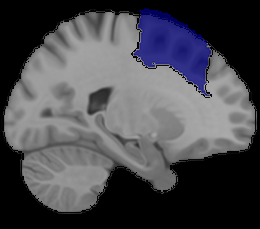 Dorsolateral Prefrontal Cortex