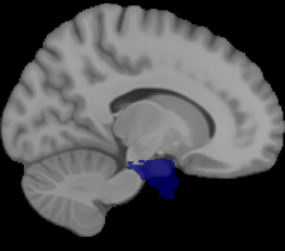 Entorhinal Cortex