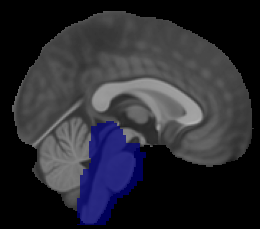 Midbrain