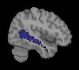Midtemporal Cortex